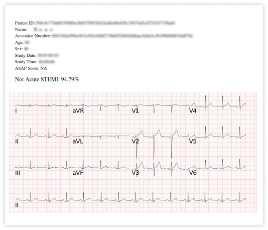 SHOWCASE_3_無STEMI 1