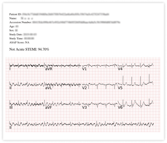 SHOWCASE_4_無STEMI 1