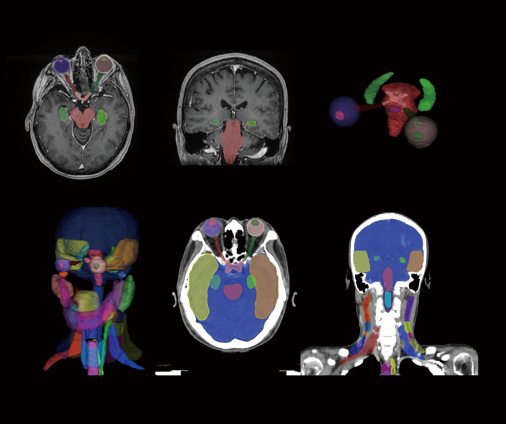 RT影像總覽圖-無字版 1