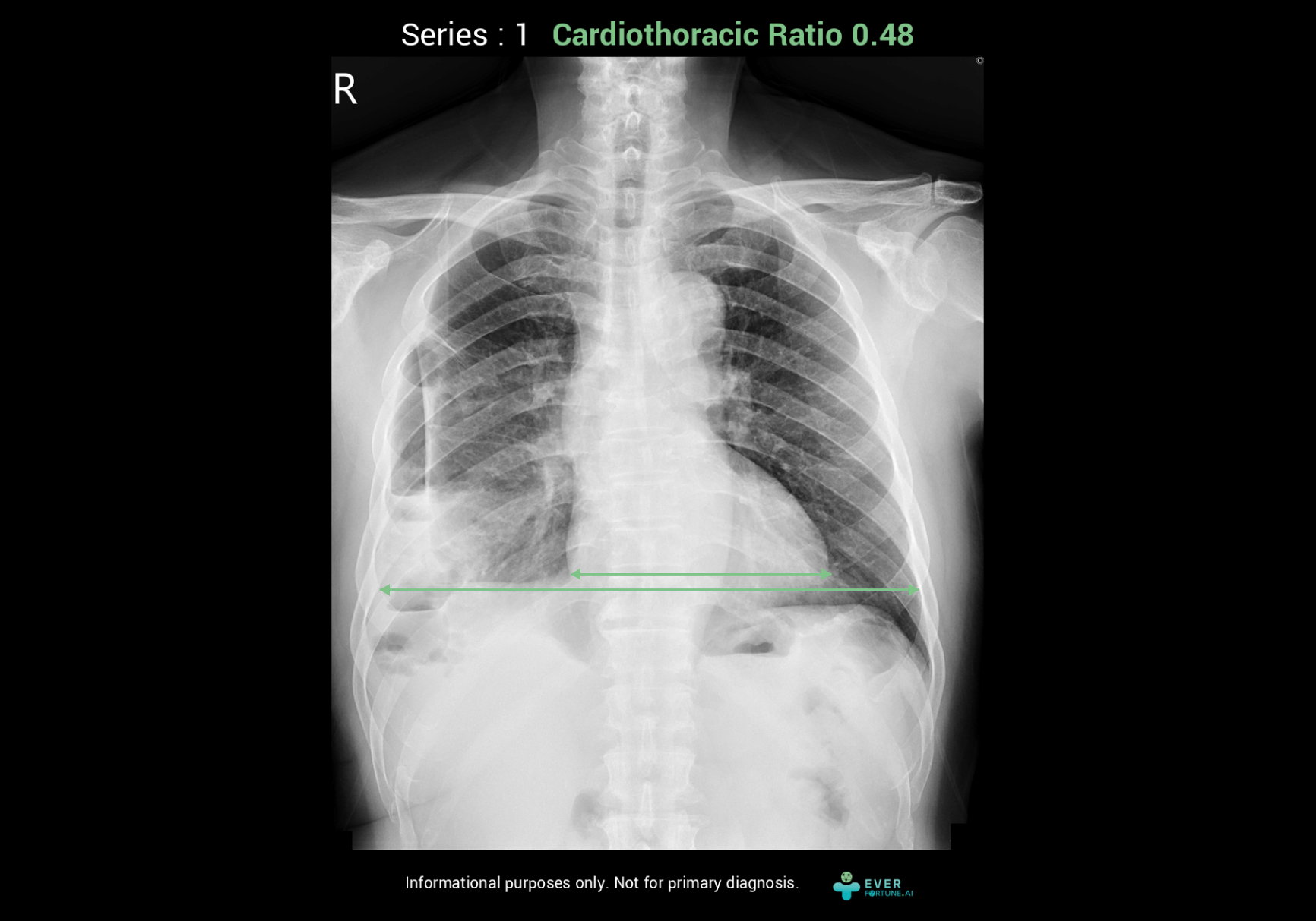 產品示意圖-更換圖檔-CXR-3-CTR